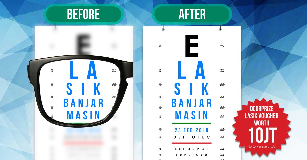 before after fb1